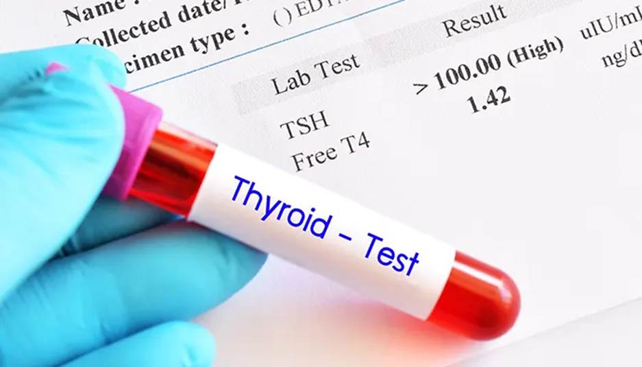 چند ساعت قبل از آزمایش تیروئید باید ناشتا بود؟