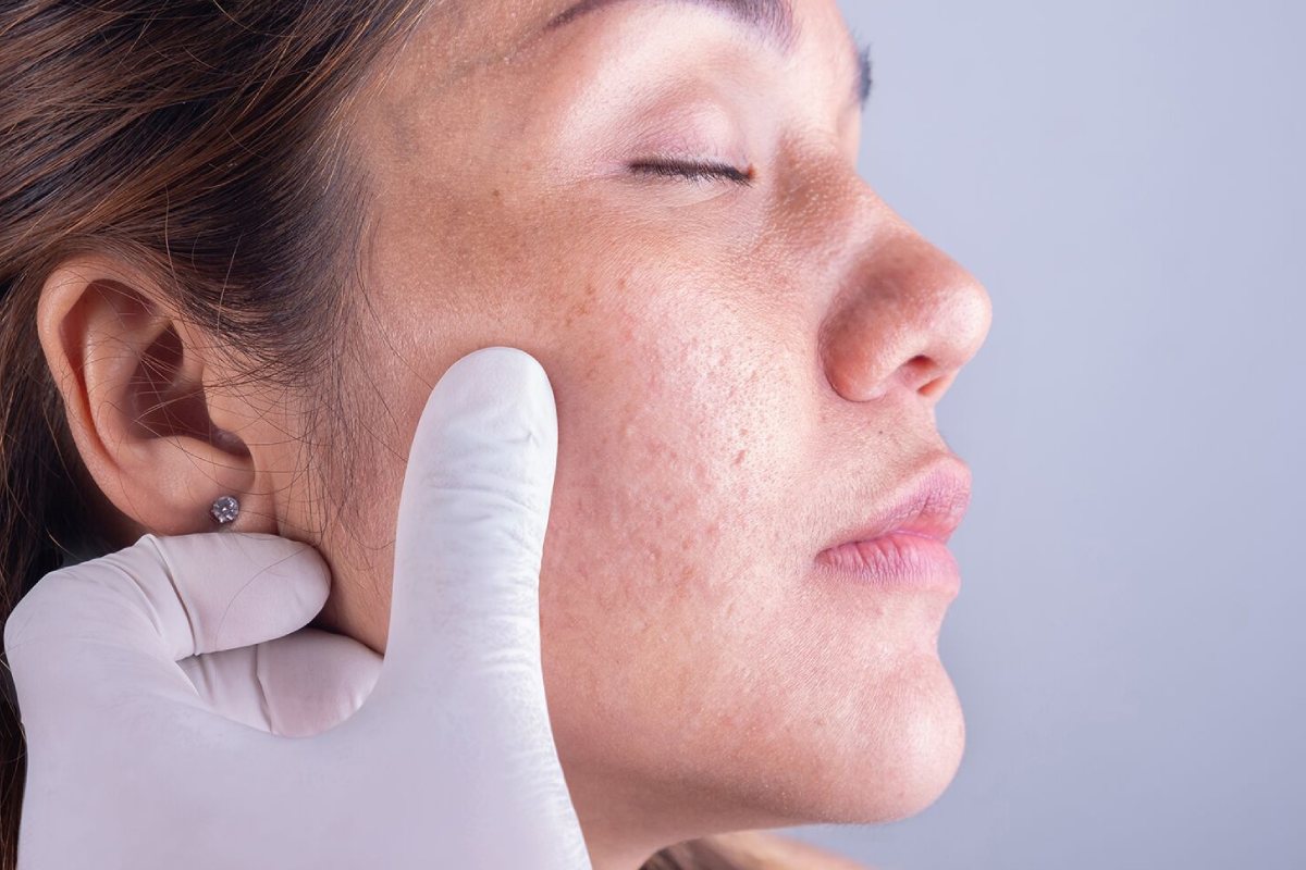 چه زمانی باید به دکتر پوست و مو مراجعه کنیم؟