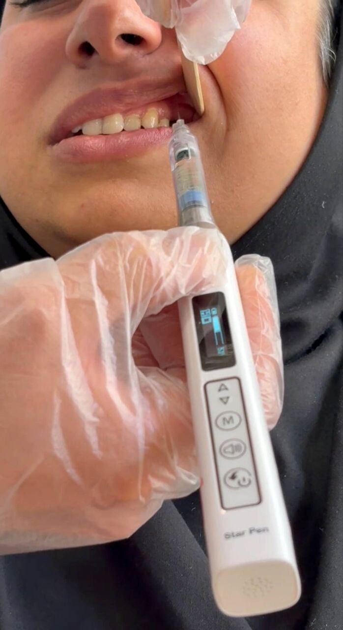 ایمپلنت دیجیتال؛ تحول فناوری در دندانپزشکی مدرن