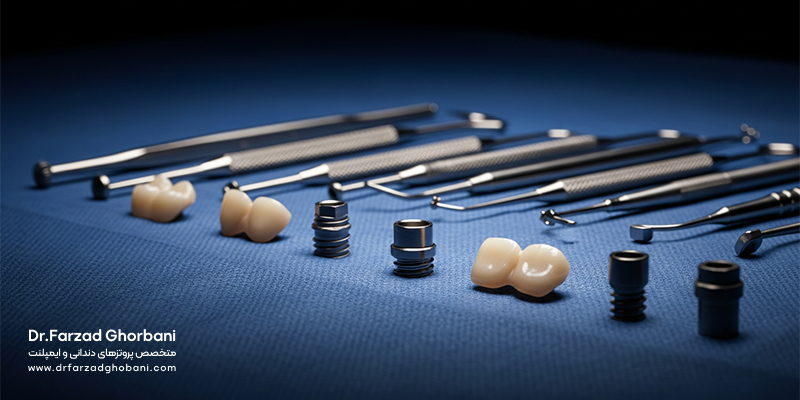 همه چیز درباره ایمپلنت دندان: مراحل، شرایط، مراقبتها و پاسخ به سوالات پرتکرار