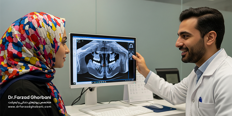 همه چیز درباره ایمپلنت دندان: مراحل، شرایط، مراقبتها و پاسخ به سوالات پرتکرار