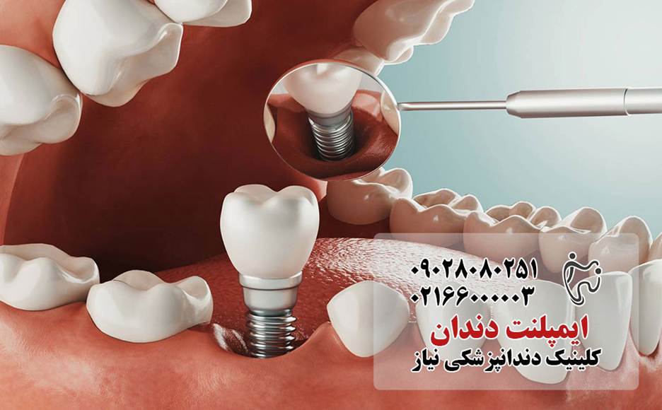 مراقبتهای دندانپزشکی که باید قبل از ۴۰ سالگی انجام دهید