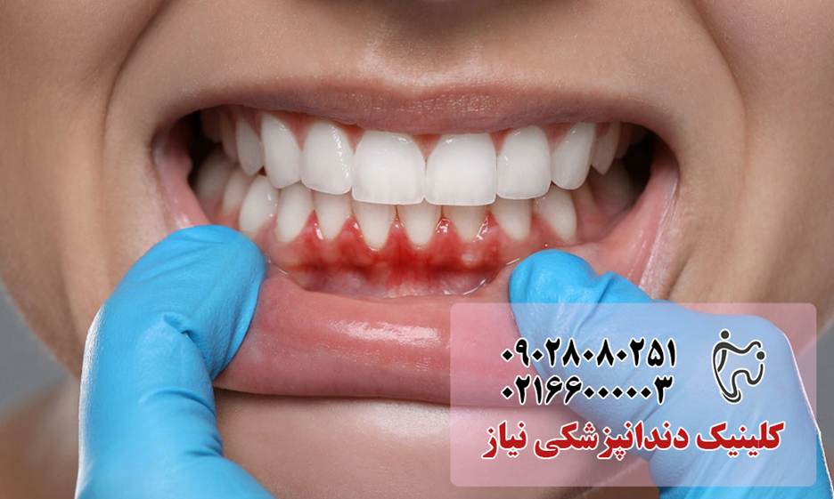 مراقبتهای دندانپزشکی که باید قبل از ۴۰ سالگی انجام دهید