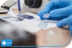 تست اچ پی وی چگونه انجام میشود؟ نکات مهم انجام آزمایش