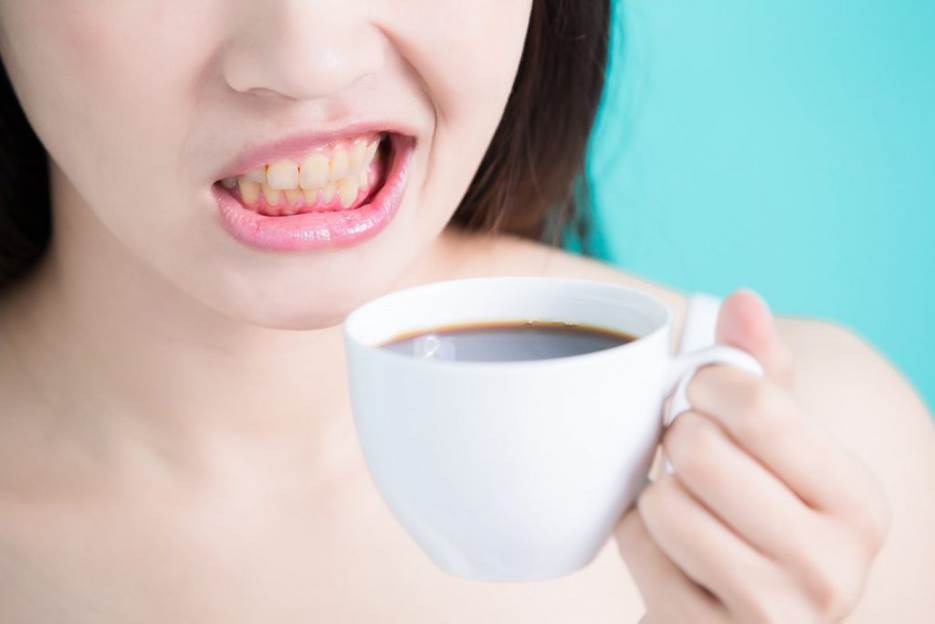 تا چند روز بعد از کامپوزیت میتوانم قهوه بخورم؟