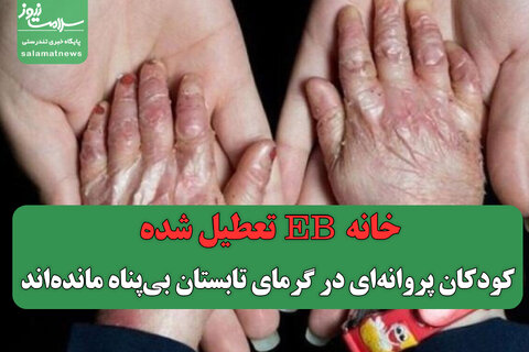 خانه EB تعطیل شده/ کودکان پروانه‌ای در گرمای تابستان بی‌پناه مانده‌اند