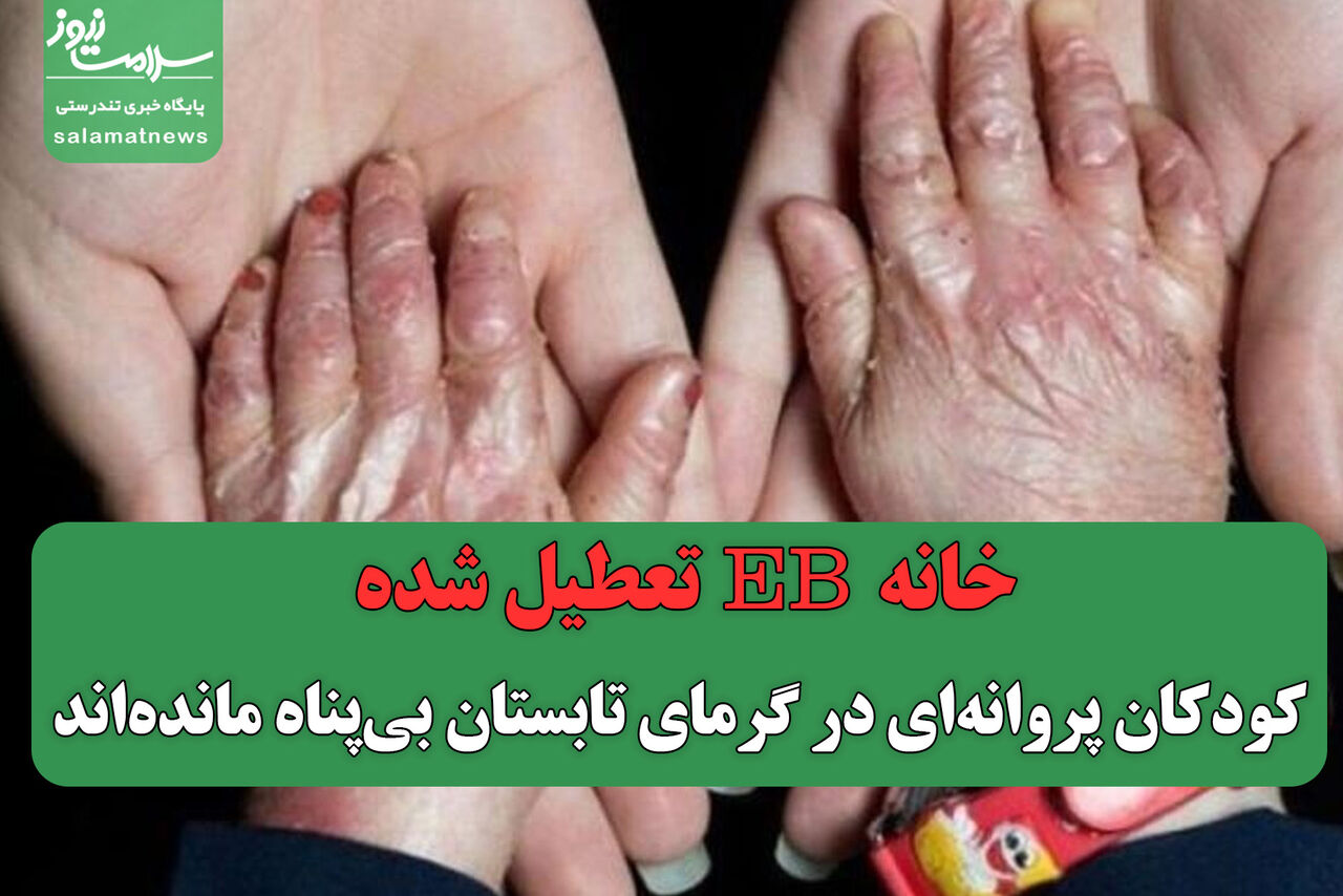 خانه EB تعطیل شده/ کودکان پروانه‌ای در گرمای تابستان بی‌پناه مانده‌اند