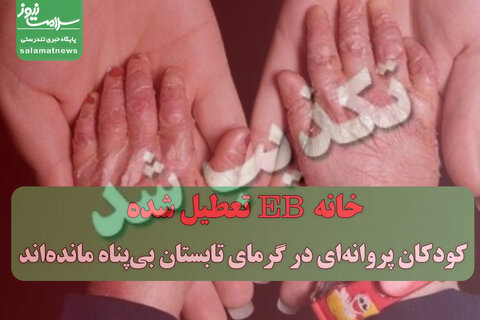 تکذیبیه خانه EB / کودکان پروانه‌ای در گرمای تابستان بی‌پناه مانده‌اند
