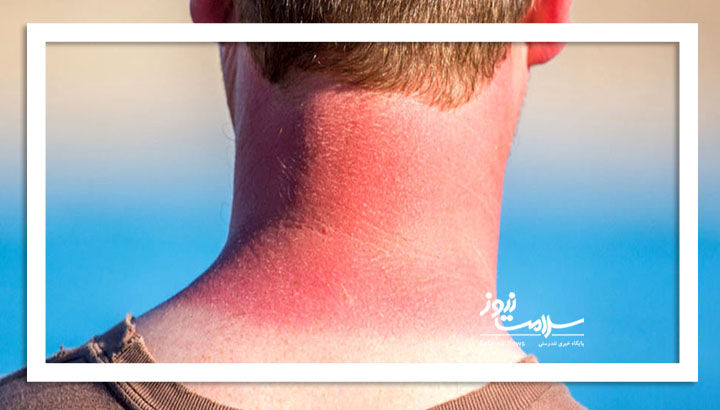 شاخص UV در تهران به مرز خطر بسیار شدید رسید؛ از آفتاب دور بمانید شاخص UV در تهران به مرز خطر بسیار شدید رسید؛ از آفتاب دور بمانید