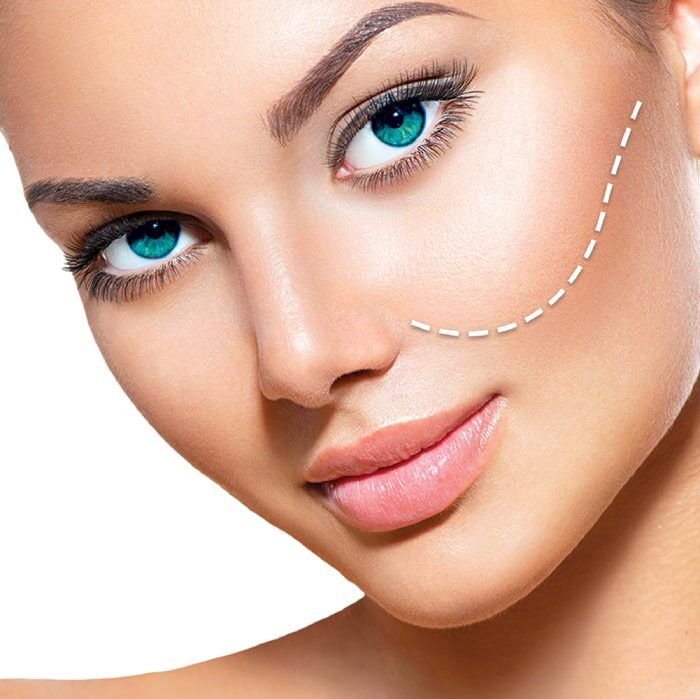 فیلر صورت؛ راز جوانی و زیبایی بدون جراحی فیلر صورت؛ راز جوانی و زیبایی بدون جراحی