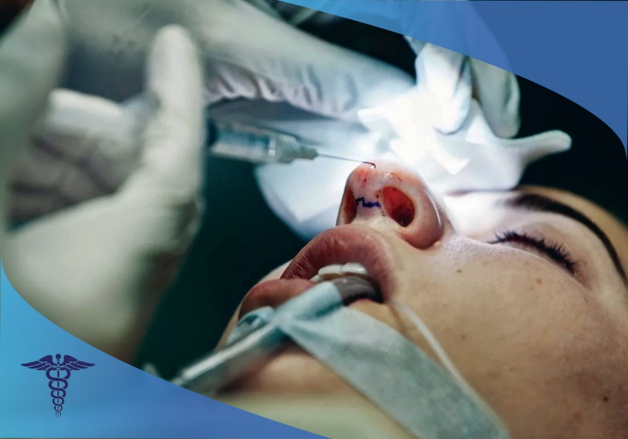 جراحی بینی در شیراز؛ فرایند زیبایی متوازن و چشم نواز