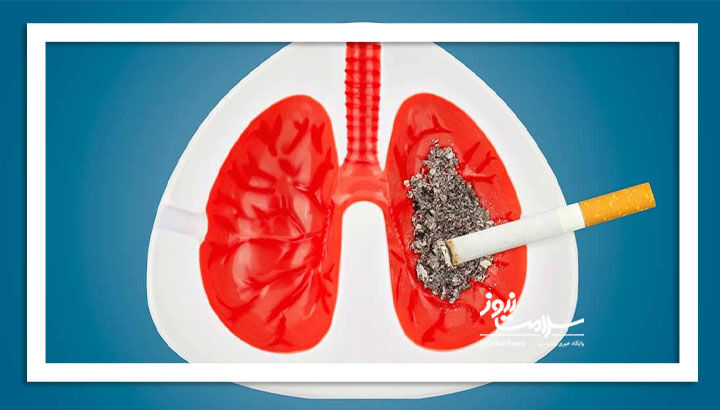 سیگار عامل 85 درصد موارد سرطان ریه