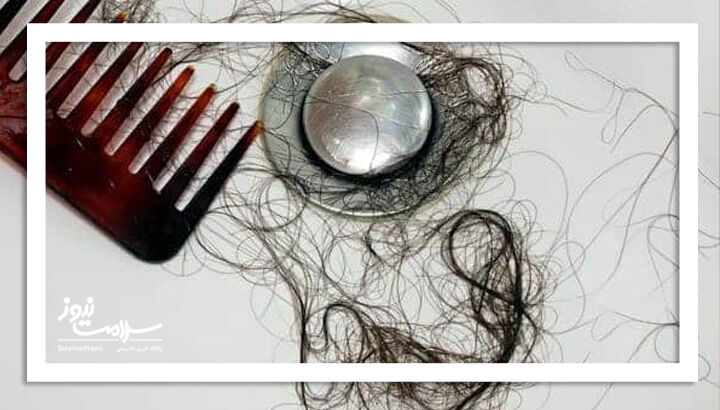 چرا موهایمان در حمام میریزد؟ چرا موهایمان در حمام میریزد؟