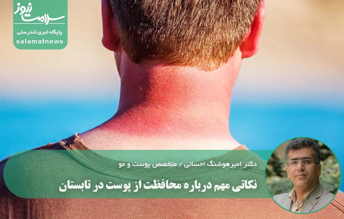 نکاتی مهم درباره محافظت از پوست در تابستان