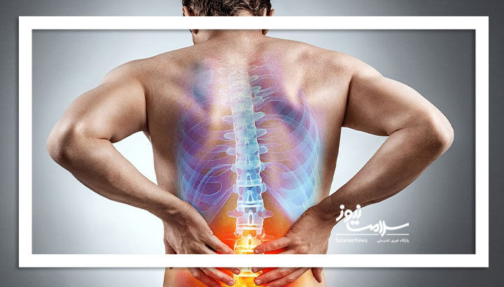 دیسک کمر با این علائم خود را نشان میدهد دیسک کمر با این علائم خود را نشان میدهد