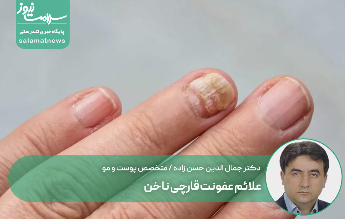 علائم عفونت قارچی ناخن