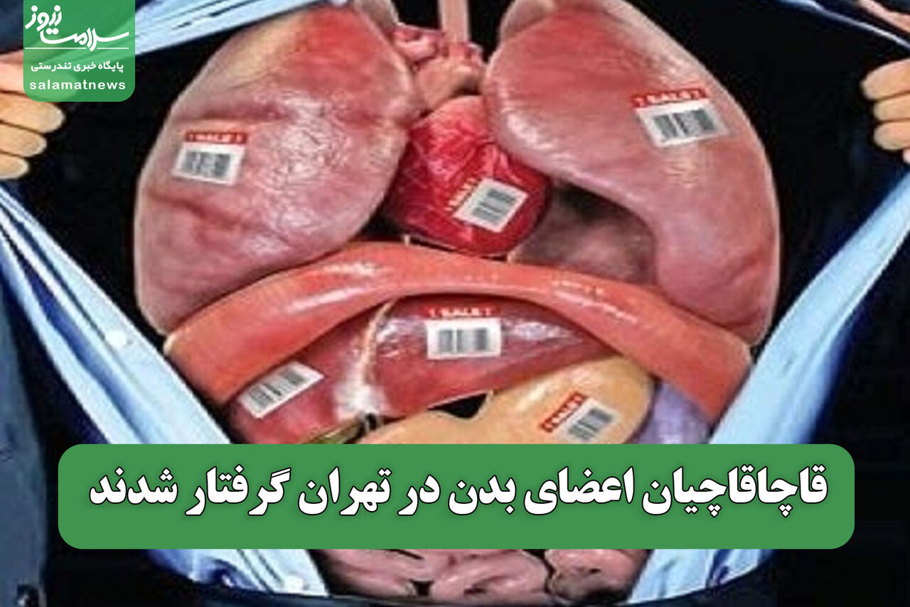 قاچاقاچیان اعضای بدن در تهران گرفتار شدند