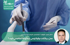 عمل برگشت وازکتومی چگونه انجام می شود؟