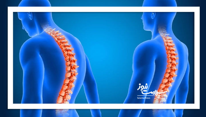 کمردرد با این راهکار شکست میخورد کمردرد با این راهکار شکست میخورد