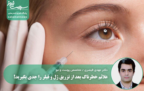 علائم خطرناک بعد از تزریق ژل و فیلر را جدی بگیرید!