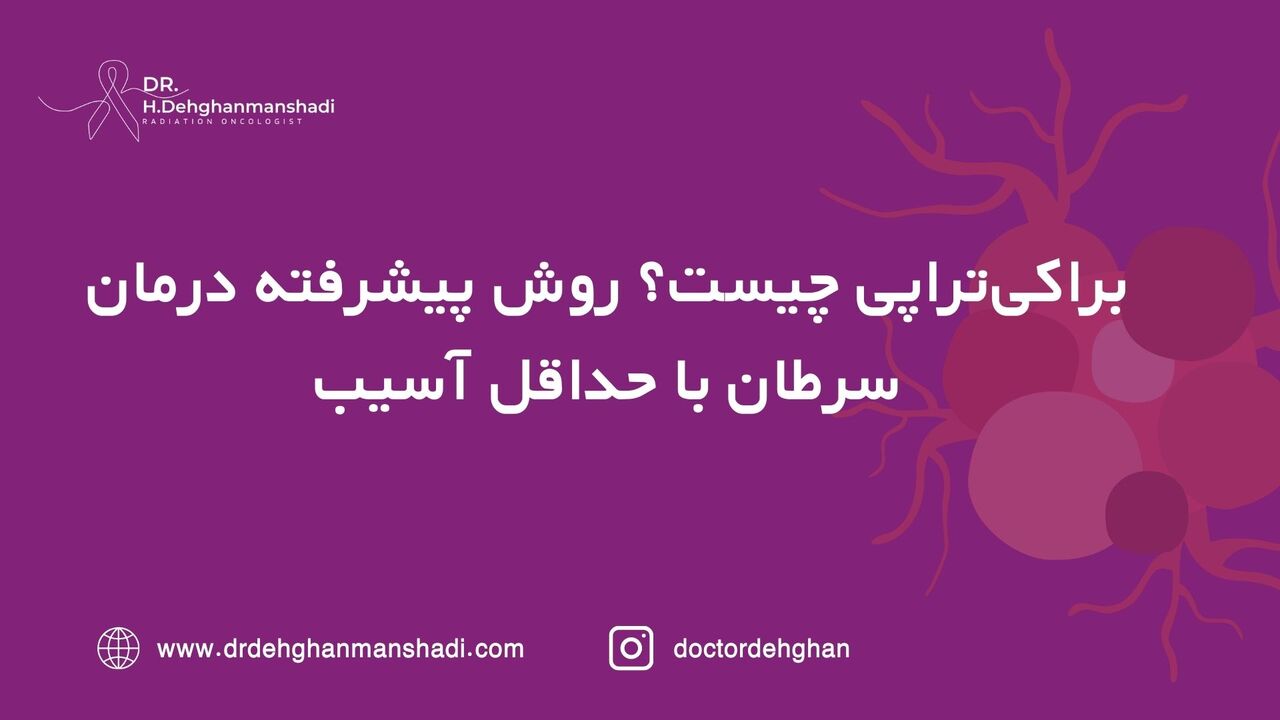 براکی‌تراپی چیست؟ روش پیشرفته در سرطان با حداقل آسیب