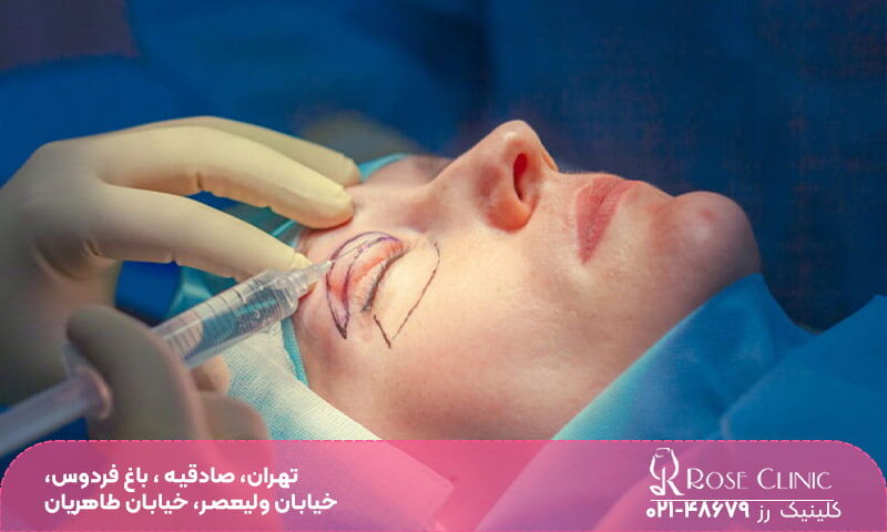 آیا عمل بلفاروپلاستی خطرناک است​؟