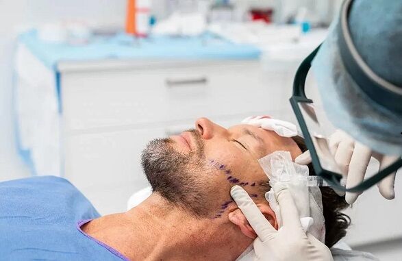 کاشت ریش دائمی هست یا موقت؟