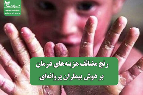 رنج مضائف هزینه‌های درمان بر دوش بیماران پروانه‌ای