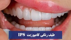 طیف رنگی کامپوزیت IPS : رنگ BLXL و رنگ bll