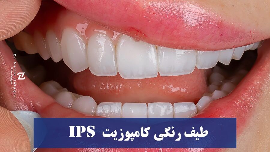 طیف رنگی کامپوزیت IPS : رنگ BLXL و رنگ bll