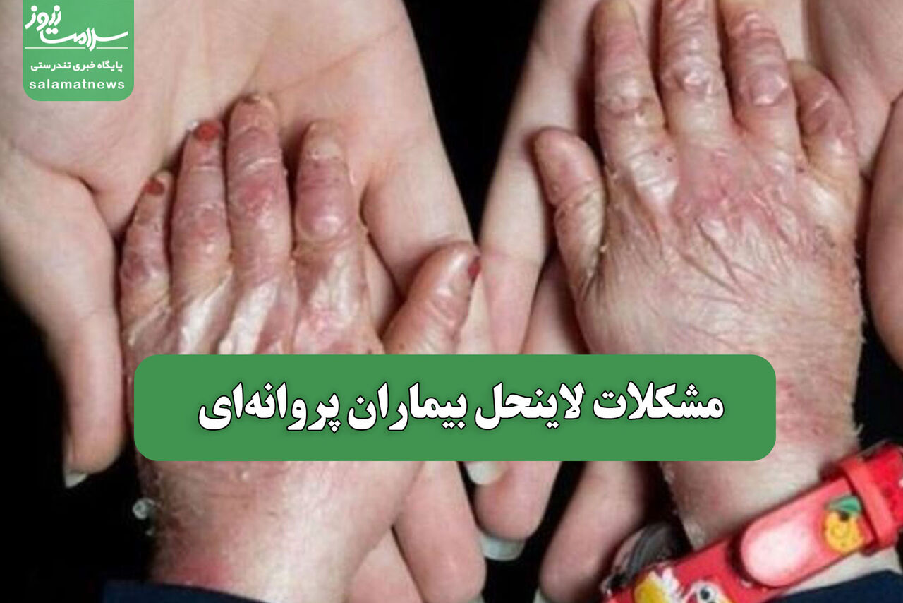 مشکلات لاینحل بیماران پروانه‌ای 