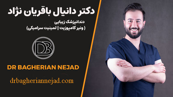 قبل از مراجعه به دندانپزشک زیبایی در اصفهان، این 5 نکته را از دست ندهید!