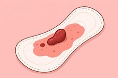 لخته خون گوشتی شبیه جگر در پریودی نشانه چیست؟ نظر دکتر زنان تهران