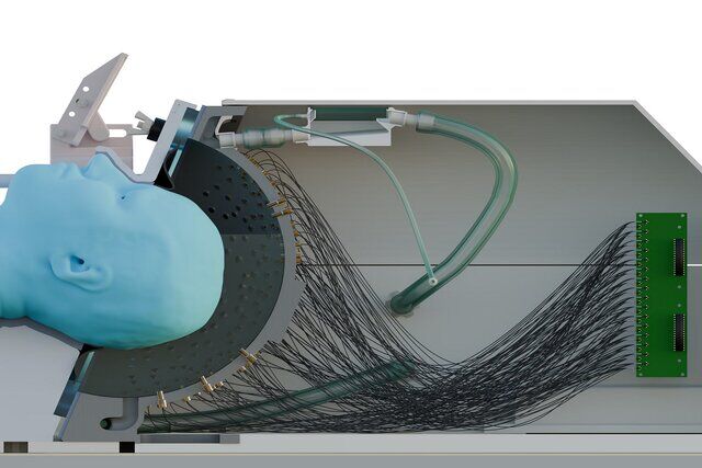 انقلابی در درمان پارکینسون با کلاه فراصوت؛ خداحافظی با جراحی مغز نزدیک است انقلابی در درمان پارکینسون با کلاه فراصوت؛ خداحافظی با جراحی مغز نزدیک است