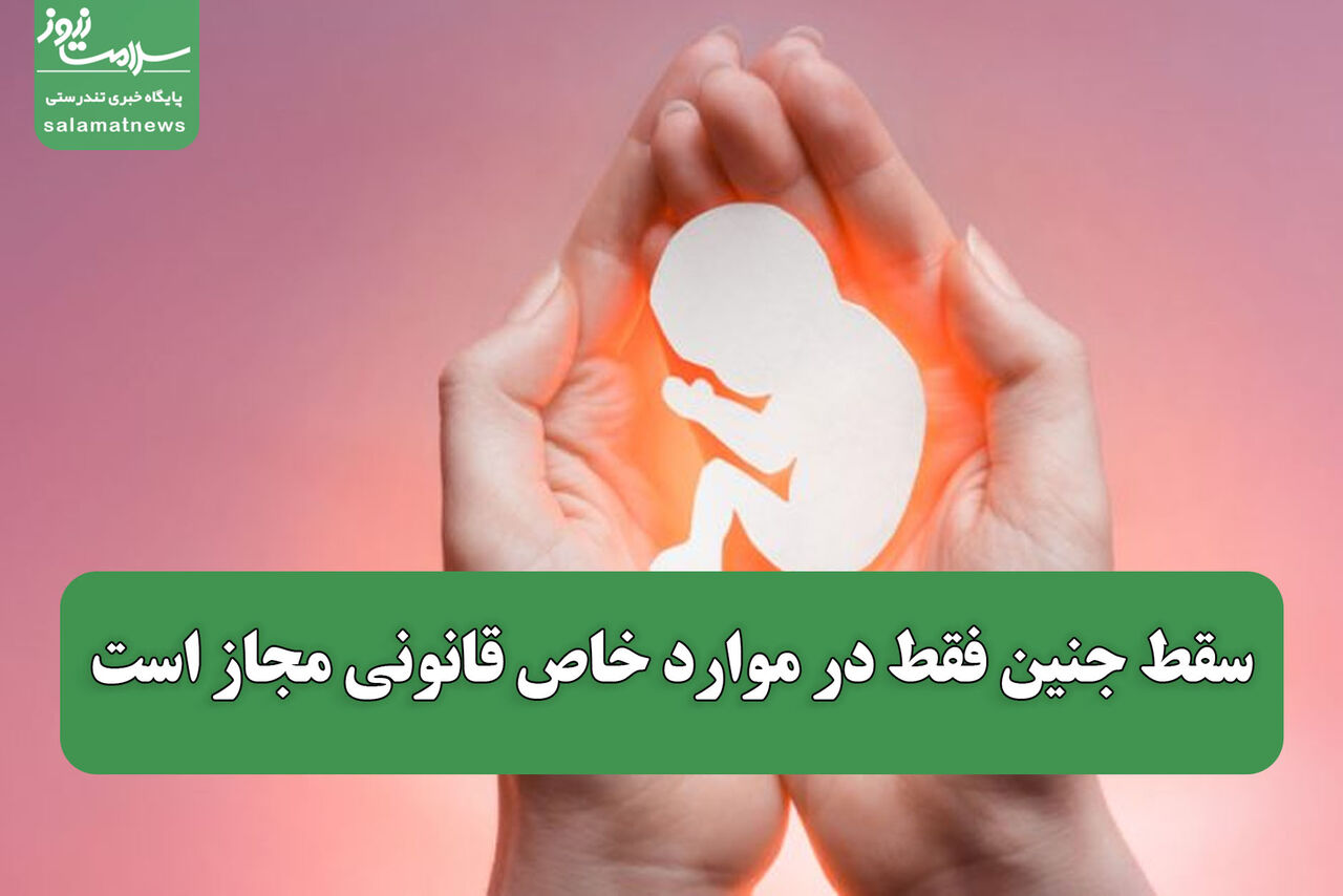 سقط جنین فقط در موارد خاص قانونی مجاز است؛ سندروم داون هم استثناء ندارد