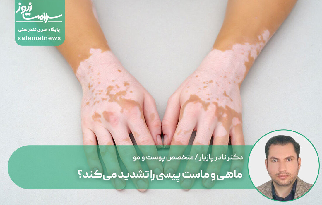 ماهی و ماست پیسی را تشدید می‌کند؟