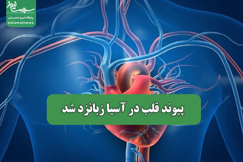 پیوند قلب در آسیا زبانزد شد