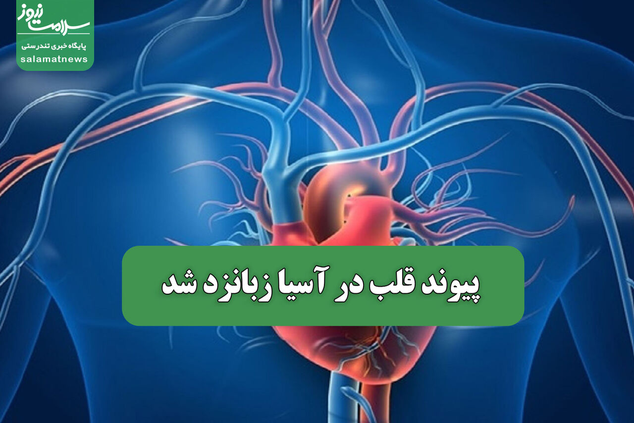 پیوند قلب در آسیا زبانزد شد