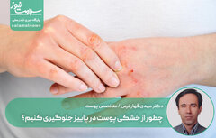 چطور از خشکی پوست در پاییز جلوگیری کنیم؟