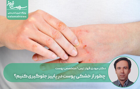 چطور از خشکی پوست در پاییز جلوگیری کنیم؟