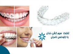 تفاوت بین ارتودنسی معمولی (با نگین و سیم) و ارتودنسی نامرئی