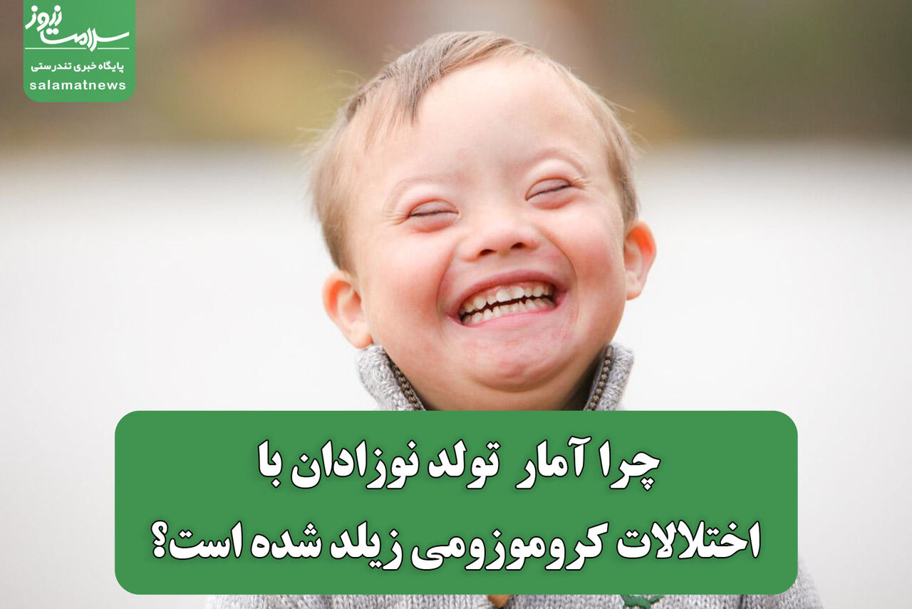 چرا آمار تولد نوزادان با اختلالات کروموزومی زیلد شده است؟