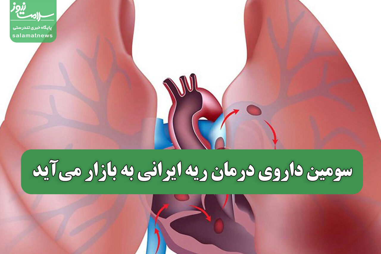سومین داروی درمان ریه ایرانی به بازار می‌آید