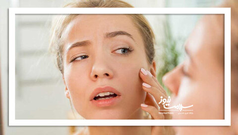 چرا گاهی صورت افراد  ورم می‌کند؟