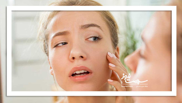 چرا گاهی صورت افراد  ورم می‌کند؟