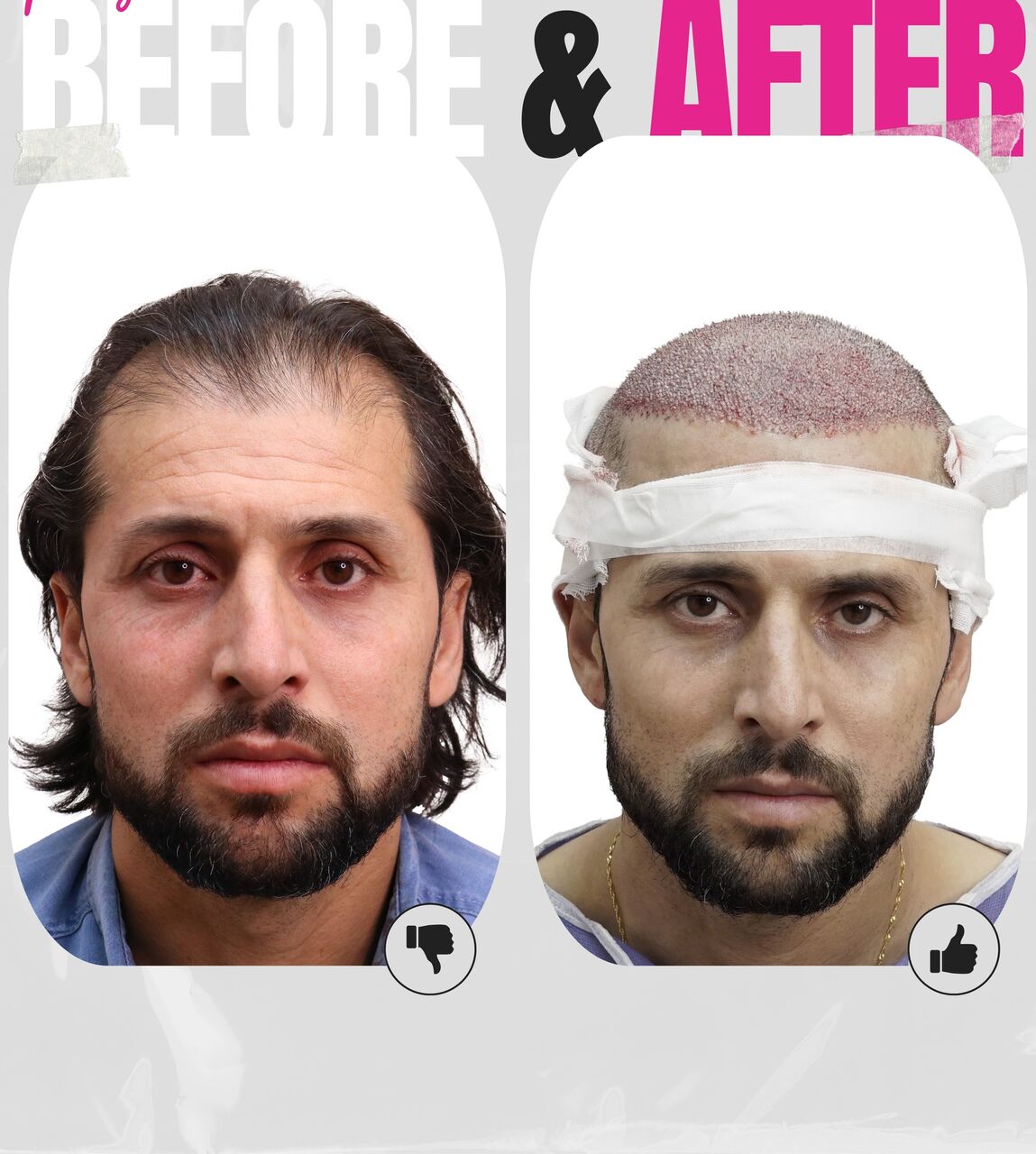 کلینیک کاشت مو در غرب تهران کلینیک کاشت مو در غرب تهران