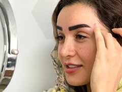 کاشت ابرو طبیعی؛ بازگرداندن زیبایی و اعتمادبه‌نفس با علم روز