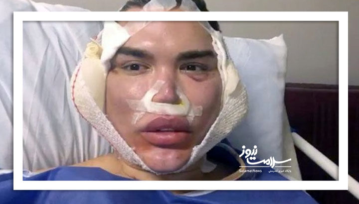 فریب خدمات زیبایی ارزان را نخورید فریب خدمات زیبایی ارزان را نخورید