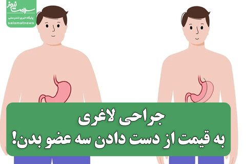 جراحی لاغری به قیمت از دست دادن سه عضو بدن!