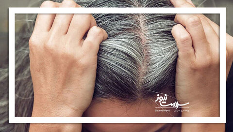 آیا سفیدی مو همیشگی است؟